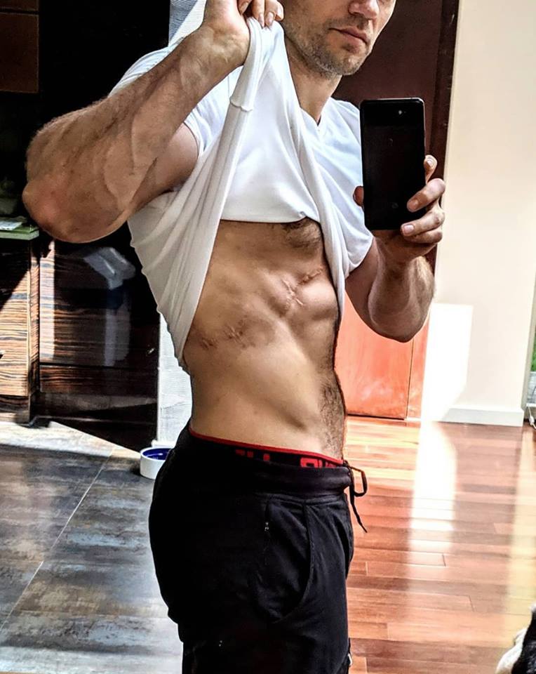 Henry Cavill Shows Off Witcher Injury and Six Pack