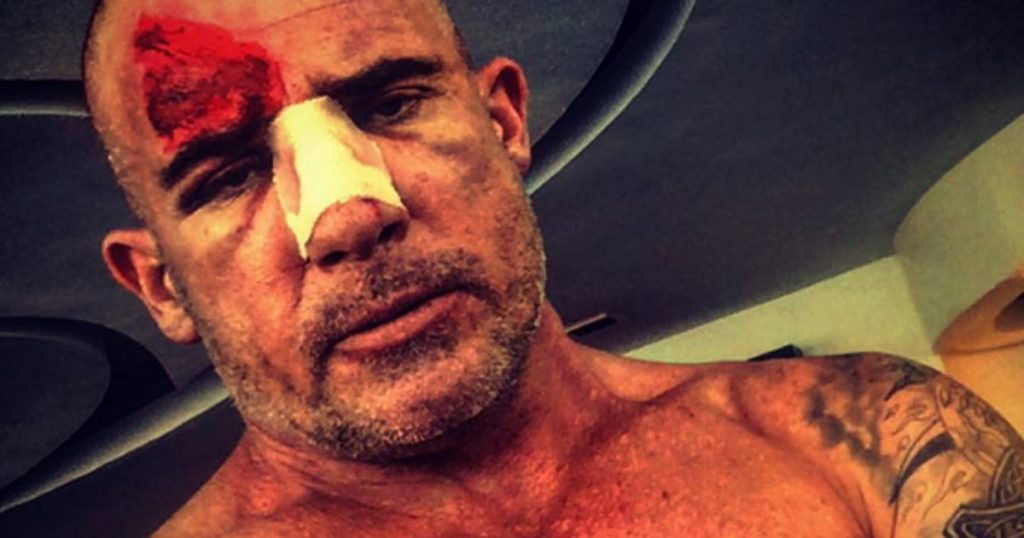 dominic-purcell-injured