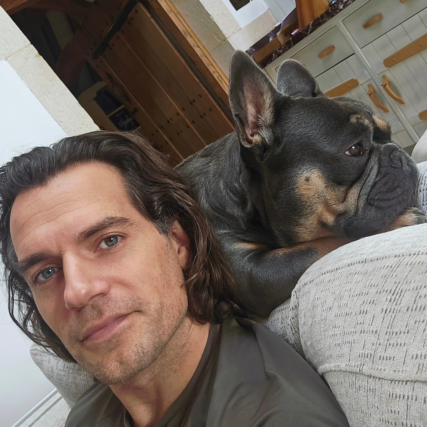 henry cavill highlander injury 1 henry cavill highlander injury 1
