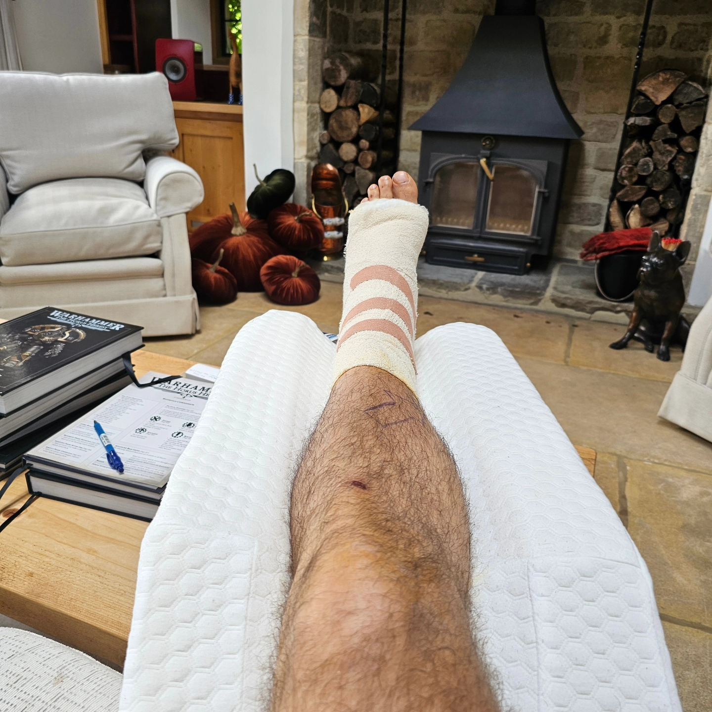 henry cavill highlander injury 2 henry cavill highlander injury 2