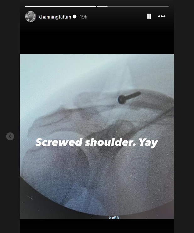 channing tatum injury 2 1